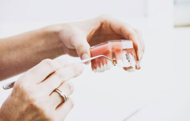 Reabilitação Oral (Próteses e Implantes)