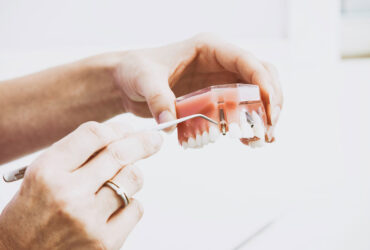 Reabilitação Oral (Próteses e Implantes)