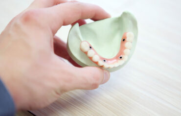 Harmonização Orofacial