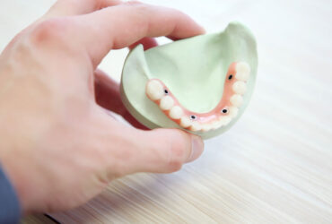 Harmonização Orofacial
